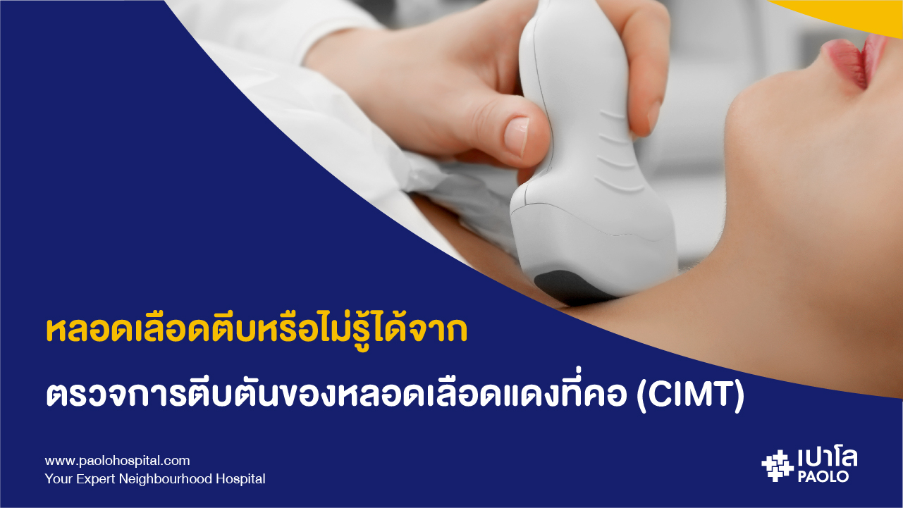 การตรวจการตีบตันของหลอดเลือดแดงที่คอ (CIMT)